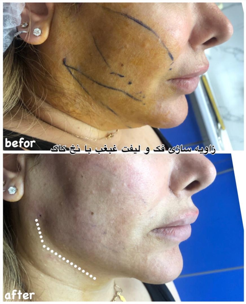 لیفتغبغب و فک