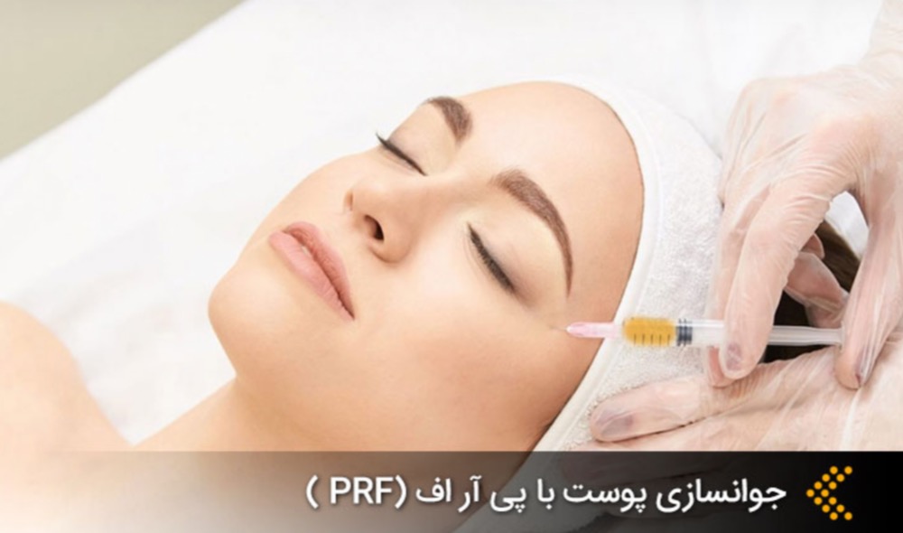 IMG_20250514_151437_741