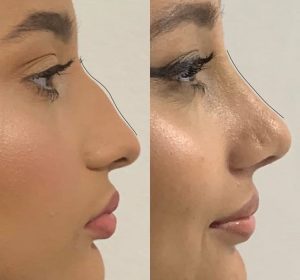 37b55019-d116-421f-803a-6057596bc411 37b55019-d116-421f-803a-6057596bc411